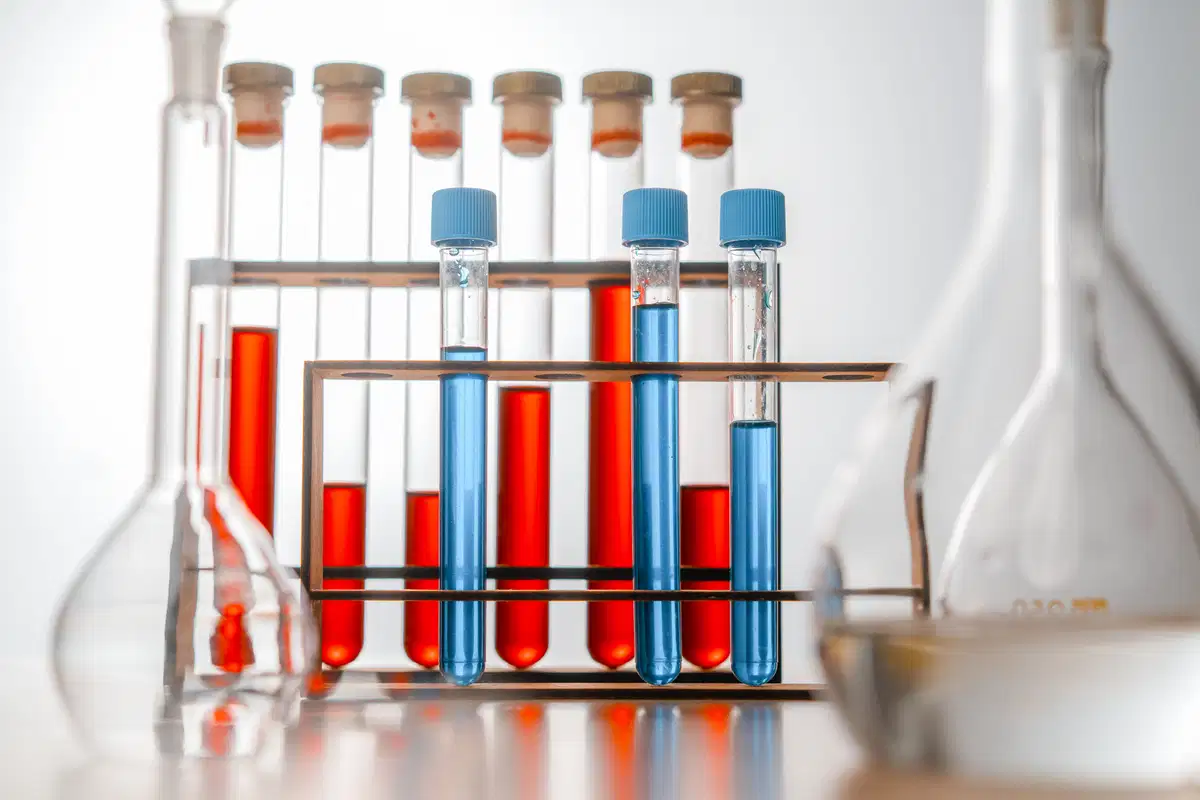 Job Cuts and Plant Closures: Rethinking the "S" in Chemical ESG Reporting